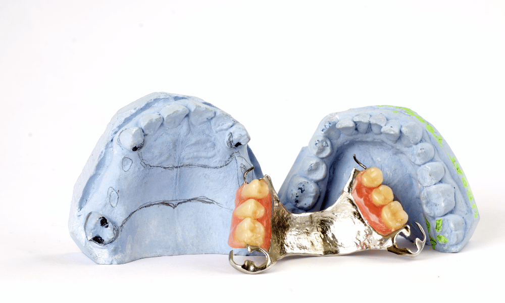 Duraflex Vs Valplast How To Choose The Best Flexible Partial Denture